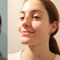 Facial Exercises: A Holistic Approach to Enhancing Cheekbones