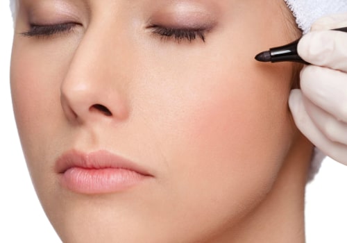 Hyaluronic Acid Fillers for Temporary Cheekbone Enhancement: Enhance Your Cheekbones Today